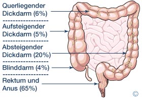 Vorkommen von Darmkrebs